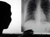 a7.medical.lungs.xray.home