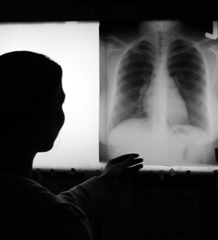 Ex Vivo Transplants Give Rejected Lungs New Life