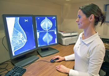 d2.breast.cancer.radiology.story