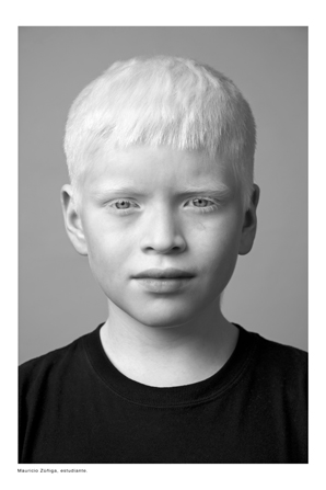 b3.muchedumbre.albino.boy.story