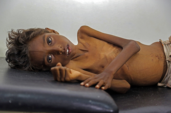 a1.crises.yemen.boy.story