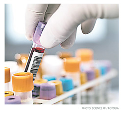 c1.medical.lab.tech.blood.tube.story