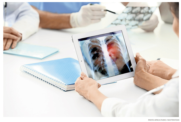New Drugs May Be Big Advance in Lung Cancer Care